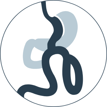 Mini-gastric Bypass / OAGB