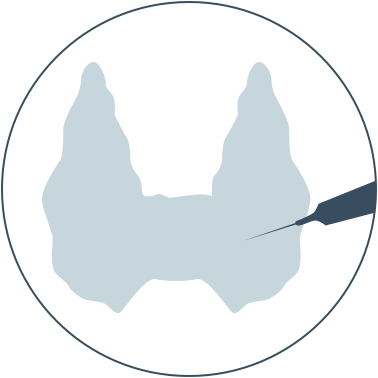 Ultrasonido tiroideo y biopsia por aspiración con aguja fina (BAAF)